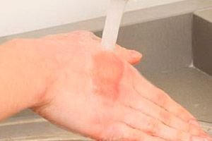 arsura de grasime la fata locului cum să-și piardă fată grasă