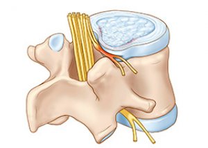 tratamentul discului spinal tratament medicamentos pentru durerile de genunchi