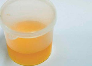 liner Demonstrate Please watch Zahăr în urină în timpul sarcinii;: norma, motivele creșterii, tratamentul