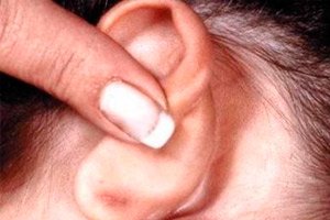 Writer flap You're welcome Inflamația ganglionilor limfatici în spatele urechii: simptome, diagnostic,  tratament