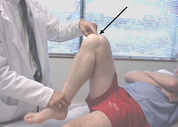 Durerea in genunchi in timpul flexiei este cel mai frecvent motiv pentru care oamenii viziteaza medici traumatici. 