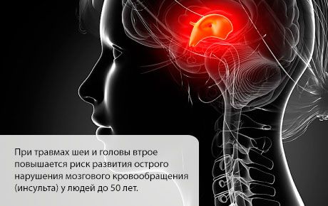 Probabilitatea apariției unui accident vascular cerebral crește în primele luni după o leziune a capului sau a gâtului